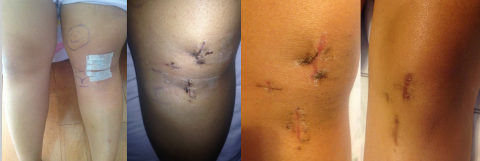 Screen Shot 2017-09-15 at 9.30.53 AM